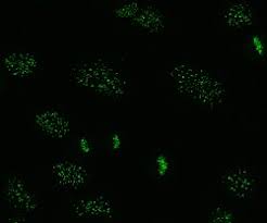 Image result for ANA Staining Pattern