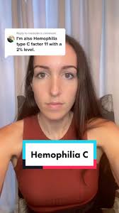 Hemophilia C Carrier Ivf