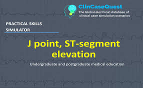 Image result for J Point