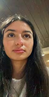 Accutite Vorher Nachher