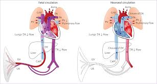 Image result for Neonatal Circulation Assessment