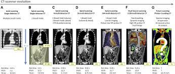 The number of computed tomographic (ct) studies performed is increasing rapidly. Technological Developments Of X Ray Computed Tomography Over Half A Century User S Influence On Protocol Optimization European Journal Of Radiology