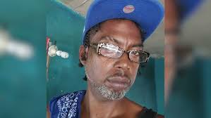 News 5 Live's Reporter Marion Ali Re-counts being Hospitalized with COVID