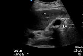 Image result for Murphy Sign