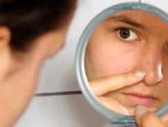 Cette lotion à la carotte, nettoie les impuretés en profondeur et prépare la peau à recevoir vos soins de beauté. Couperose Rosacee D Ou Viennent Ces Rougeurs Au Visage