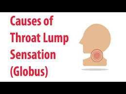Causes Of Throat Lump Sensation Globus Youtube
