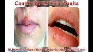 We did not find results for: Contoh Sipilis Pada Wanita Youtube