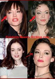Among the secrets and revelations contained within the pages, rose revealed the true reason for her eye plastic surgery. Rose Mcgowan Plastic Surgery And Celebrities