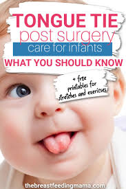 Tongue Tie Post Revision Care: Tips for Success + Printables — The  Breastfeeding Mama