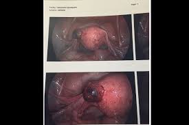 Up to a quarter of pregnant woman have light spotting during the first trimester of pregnancy. Early Pregnancy And Painless Spotting Clinical Advisor
