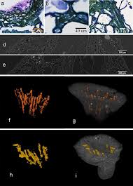 Cas confirmés, mortalité, guérisons, toutes les statistiques A Correlation Analysis Of Light Microscopy And X Ray Microct Imaging Methods Applied To Archaeological Plant Remains Morphological Attributes Visualization Scientific Reports