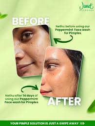 Brighten up your skin with Sri Lanka's No.01 Natural Bleaching Cream 🧡🍊  Islandwide delivery available 📦🚚 #bleaching #brightening #janetsrilanka