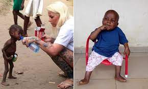 News came of the famine, and there were pictures of emaciated children on the tv.• Care Worker Reveals How Nigerian Witch Child Is Much Healthier Since Image Daily Mail Online
