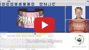 One cannot deny the confidence that perfect straight teeth bring. Invisalign Atlanta Orthodonic Specialists