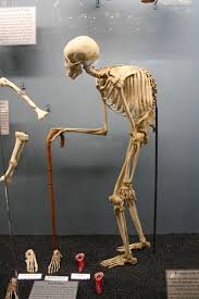 It's the progenitor of frameworks like ember, angular, even meteor. How Do I Know If My Back Pain Is Due To A Fracture