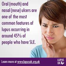 Lupus UK