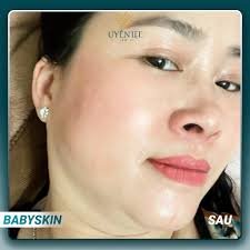 Thẩm mỹ Uyên Lee