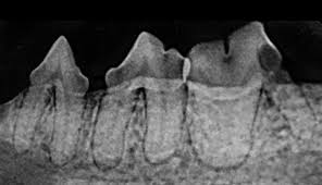 Tooth resorption, formerly termed resorptive lesions, is a phenomenon that results in painful erosions in the surface of the tooth and/or bony replacement of the roots. External Tooth Resorption In Cats Today S Veterinary Practice