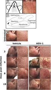 We did not find results for: Modeling The Pathology Immune Responses And Kinetics Of Hsv 1 Replication In The Lip Scarification Model Sciencedirect