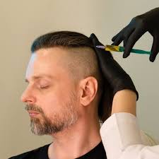 The 5 Confidence-Boosting Benefits of PRP Therapy You Need to Know