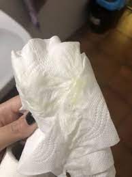 Flujo Amarillo Clarito Alerta Club Junio 2019 Embarazo Y Bebes Babycenter