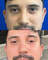 Carlos Andres Diaz Diaz (@drcarlosdiazd) · Instagram 照片和视频