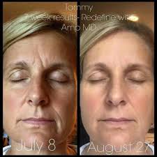 Rodan + Fields Skin Care with Sam and Anju