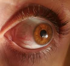 Can call himself a world record holder after he was able to flip his eyelids inside out 30 times in 30 seconds. Something Is Moving In My Eyelid