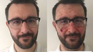 Aktuelle hintergrundinformationen und wissenswertes rund um das thema hautkrebs. Melanomrisiko Archive Hautarztpraxis Dr Kirschner