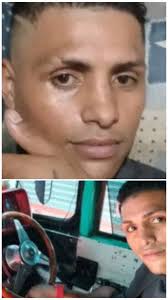 🔴Familia de Erick Acevedo pide traslado a hospital de alta especialidad⬇️  Erick Vicente Acevedo Romero es chofer de microbús, al momento de la  explosión de una pipa de gas circulaba por el