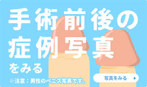 包茎手術 早漏治療 亀頭 陰茎増大なら船橋中央クリニック