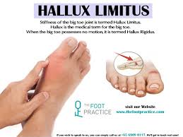 Gait Analysis In Singapore Medical Terms Analysis Injury Rehabilitation
