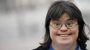Mar 21, 2011 · world down syndrome day (wdsd), 21 march, is a global awareness day which has been officially observed by the united nations since 2012. Praena Test Auf Down Syndrom Ist Illegal Politik