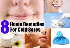 8 Home Remedies For Cold Sores Cold Home Remedies Cold Sores Remedies Cold Sore