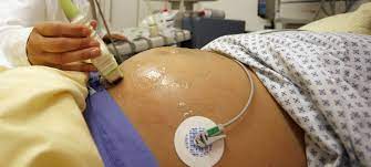 Ab wann die schwangerschaft mit ultraschall festgestellt wird. Wie Wachst Ein Baby Im Bauch Duda News