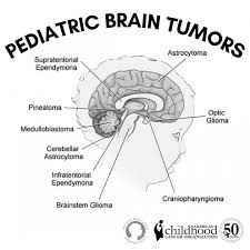 Brain tumor awareness month began as brain tumor action week, established by the north american. Brain Tumor Awareness Month Acco