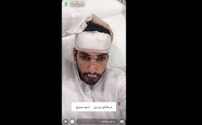 بعد تعرضه لحادث سير عبدالله بن دفنا أبشركم بأني بخير أخبار صحيفة الرؤية