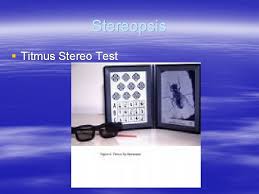 May 28, 2021 · afl blockbuster saved as dees test negative melanie dinjaski. Binocular Vision Fusion And Accommodation Fusion Development In