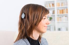 Image result for Cochlear Implant