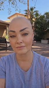 Sharon Seibel was shocked by her pancreatic cancer diagnosis. Even with a  family history of ovarian cancer and a BRCA mutation, she didn't realize  there was a connection to pancreatic cancer. After