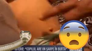 Femeia sarpe sezonul 2 episodul 2 online. Snake In A Child S Belly Stomach Sarpe In Burta Unui Copil Youtube