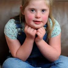 The world would be a much poorer place without people with Down's Syndrome  like amazing Lola'