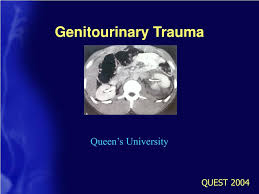 Image result for Genitourinary Trauma