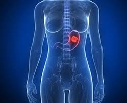 Animation permettant de comprendre les symptômes précoces, l'évolution de symptômes et les traitements possibles du cancer de l'estomac. Tumeur De L Estomac Symptomes Traitement Definition Docteurclic Com