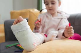Image result for Fractures in Children