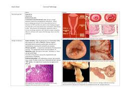 Benign cervical tissue (transformation zone with squamous metaplasia and benign endocervical glands. Cervix
