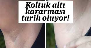 koltuk alti beyazlatma koltuklar koltuk alti bilgi