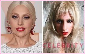 Lady Gaga Plastic Surgery She Wasn T Born This Way Plastic Surgery Before And After Plasticsurgery Bef Lady Gaga Plastic Surgery Plastic Surgery Nose Job