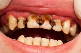 images?q=tbn:ANd9GcSEvkYF3x-CaG6ehJUUMPy7gqYtPsSmi86vRw&s