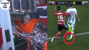 Lesión del goleador mexicano hirving «chucky» lozano no sería grave. Mexicaanse Horrorblessure Gapend Gat In Enkel Lozano Foto Sportnieuws
